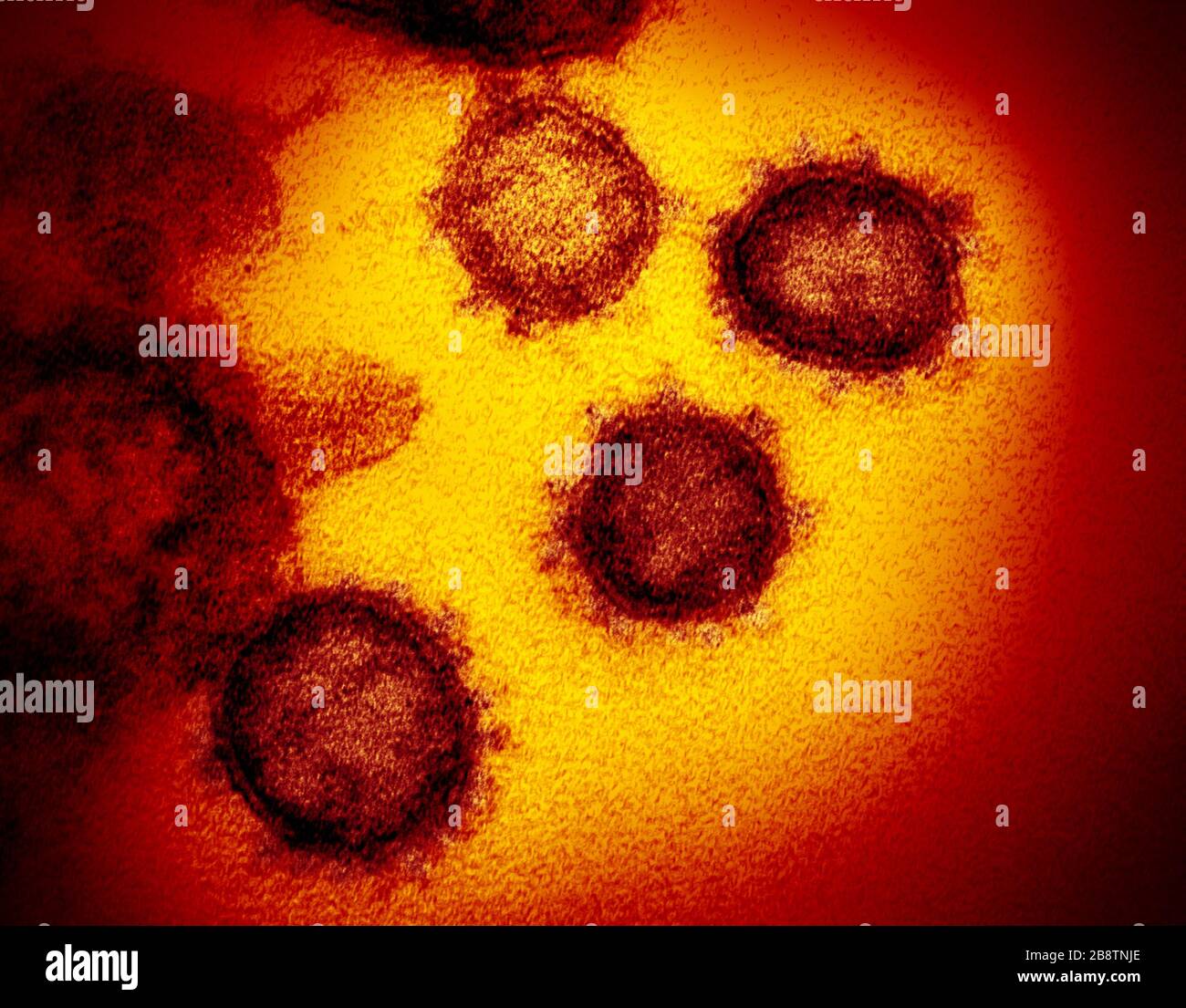 Coronavirus covid-19 [SPE2B8TNJE]
