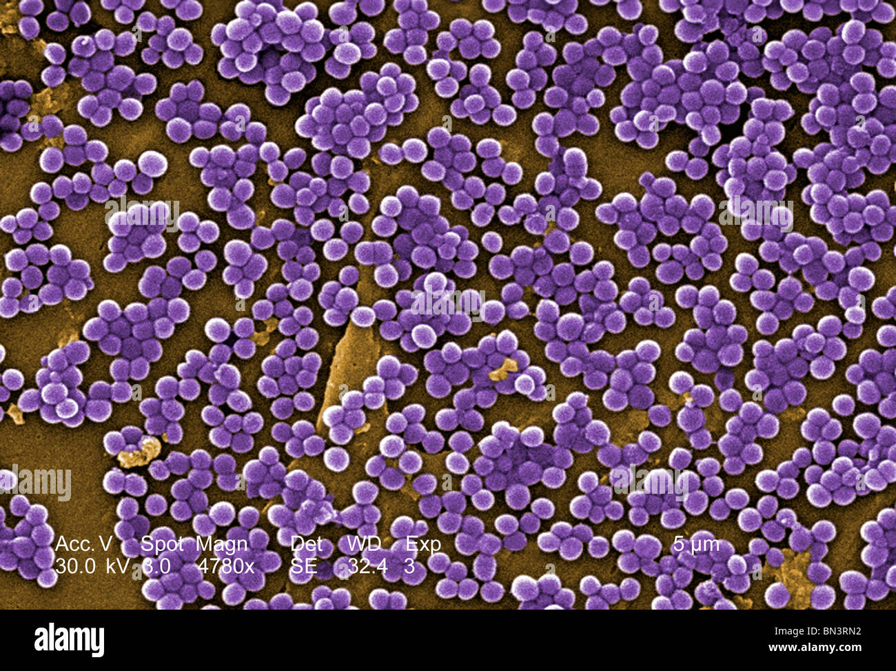 Scanning Electron Micrograph (SEM) of methicillin-resistant Staphylococcus aureus bacteria, commonly known as MRSA [SPEBN3RN2]